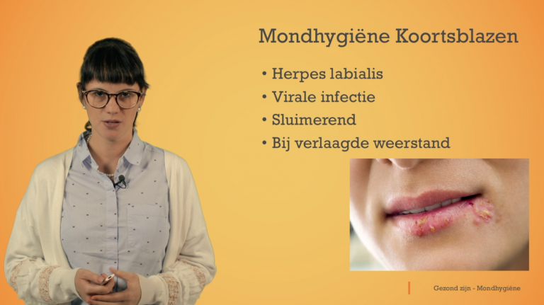 Mondhygiëne: koortsblazen